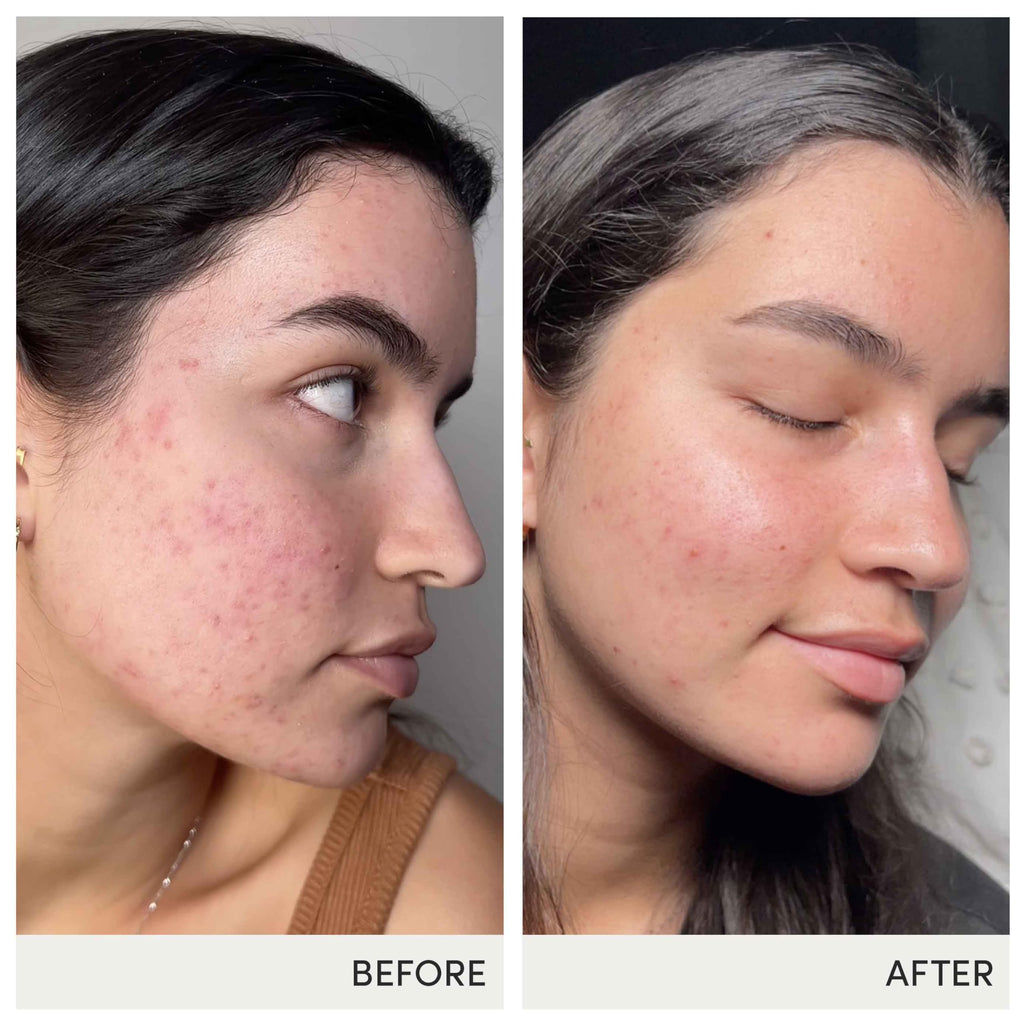 jane iredale Advanced Nutrition Programme Skin Accumax Supplement distributed by jane iredale, 60-day supply