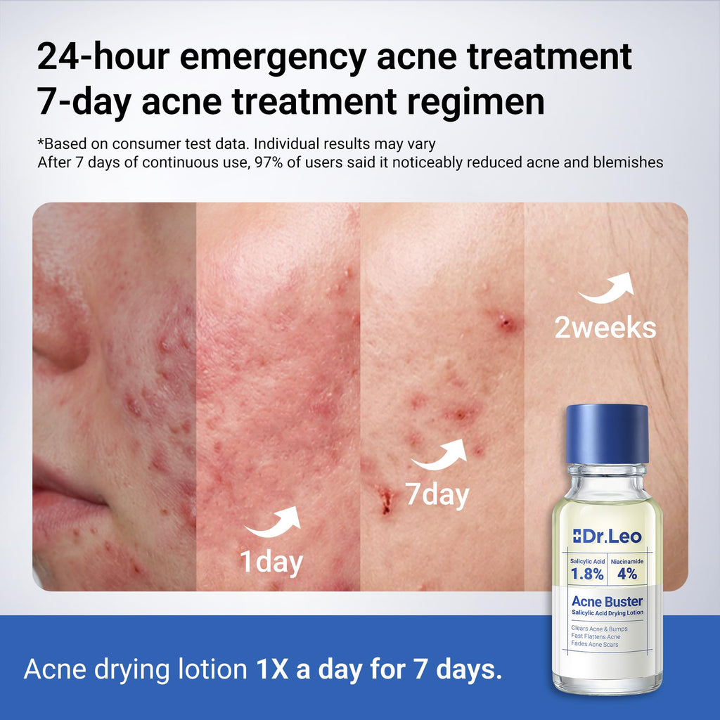 Dr.Leo 1.8% Salicylic Acid Spot Serum, Acne Treatment for Acne-Prone Sensitive Skin | Niacinamide, Fast Pimple Relief, Fades Acne Marks, Overnight & Period Breakouts, 0.34 fl oz (20 ml)