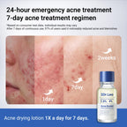 Dr.Leo 1.8% Salicylic Acid Spot Serum, Acne Treatment for Acne-Prone Sensitive Skin | Niacinamide, Fast Pimple Relief, Fades Acne Marks, Overnight & Period Breakouts, 0.34 fl oz (20 ml)