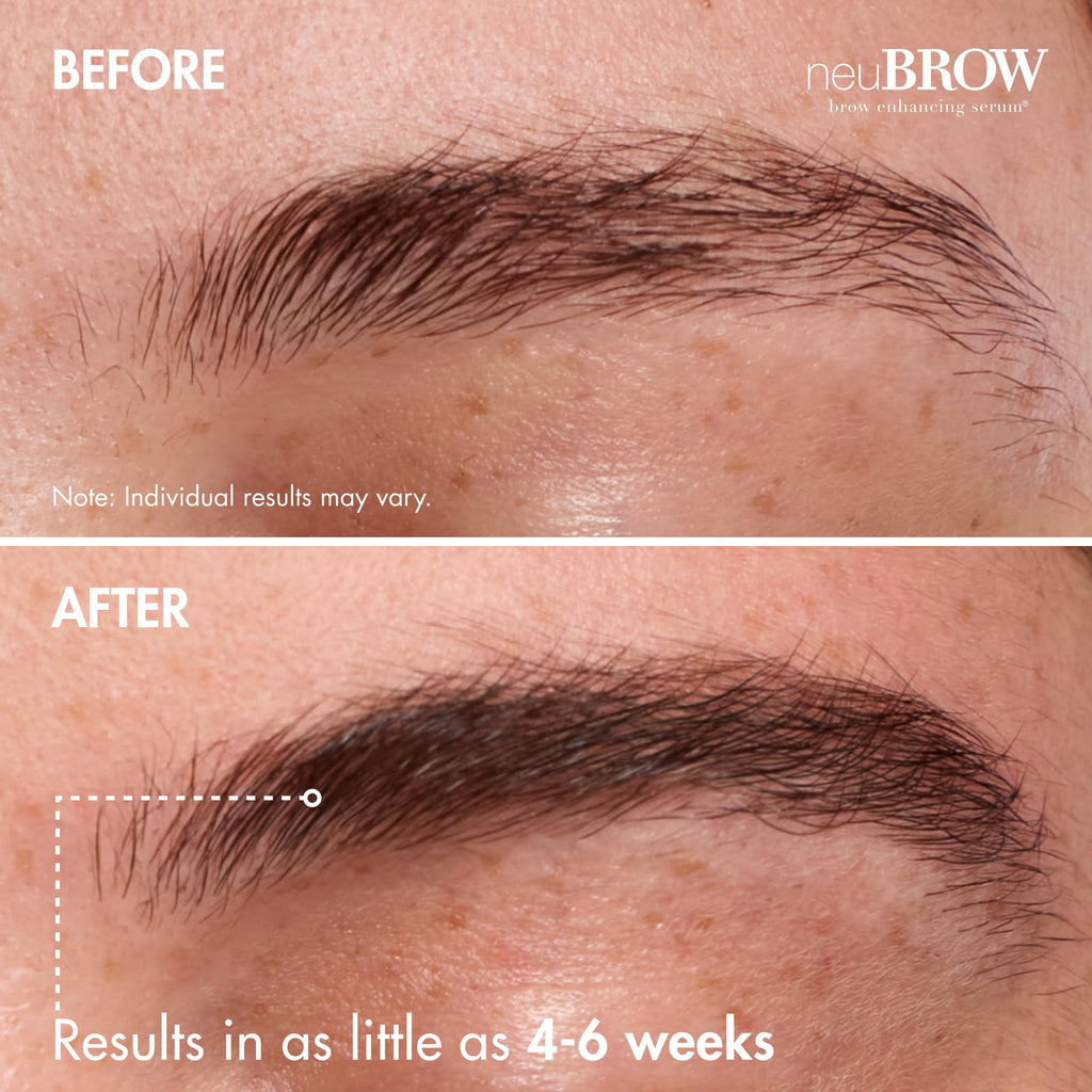 neuBROW Brow Enhancing Serum by Skin Research Laboratories - 3.6 mL Eye Brow Serum for Defined, Fuller & Thicker-Looking Hair Brows - Advanced Formula Promotes Natural & Healthy Appearance of Brows