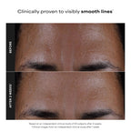 Paula's Choice SKIN PERFECTING 2% BHA Liquid Leave-On Exfoliant, 4 Fl Oz