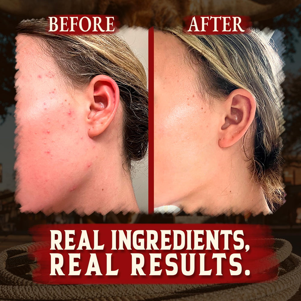 Organic Beef Tallow for Skin - 4 OZ (Unscented) — Grass Fed Beef Tallow for face + Body — US-Made Whipped Tallow and Honey Balm Moisturizer for Dry and Sensitive Skin, Eczema, Rosacea (No Additives)