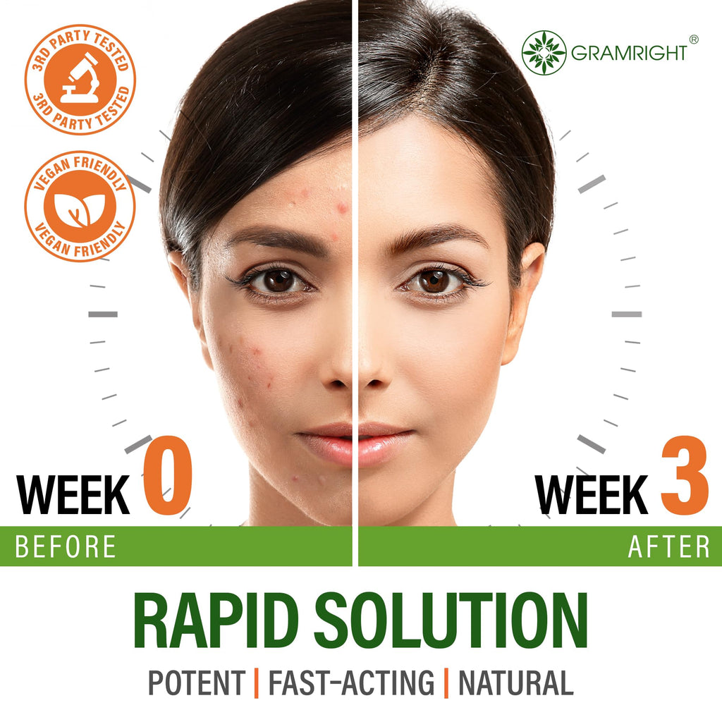 Perfect Skin Acne Pills - Clear Skin Supplement with Niacinamide, Probiotic, Zinc & Vitamin A - Anti Acne Vitamins for Teens, Men & Women - Support for Face & Back Acne, Acne Scars - 60 Capsules