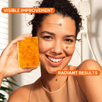 OAKDOLCHE 25P Turmeric Kojic Acid Soap Gift Set, Individually Wrapped (80g) | Infused with Retinol, Collagen & Vitamin E, SLS Free Gentle Care for Face/Body, Suitable for Party & Holiday Gifting