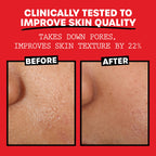 THAYERS Alcohol-Free, Hydrating Rose Petal Witch Hazel Facial Toner with Aloe Vera Formula, Vegan, Dermatologist Tested and Recommended, 12 Oz (Pack of 2)