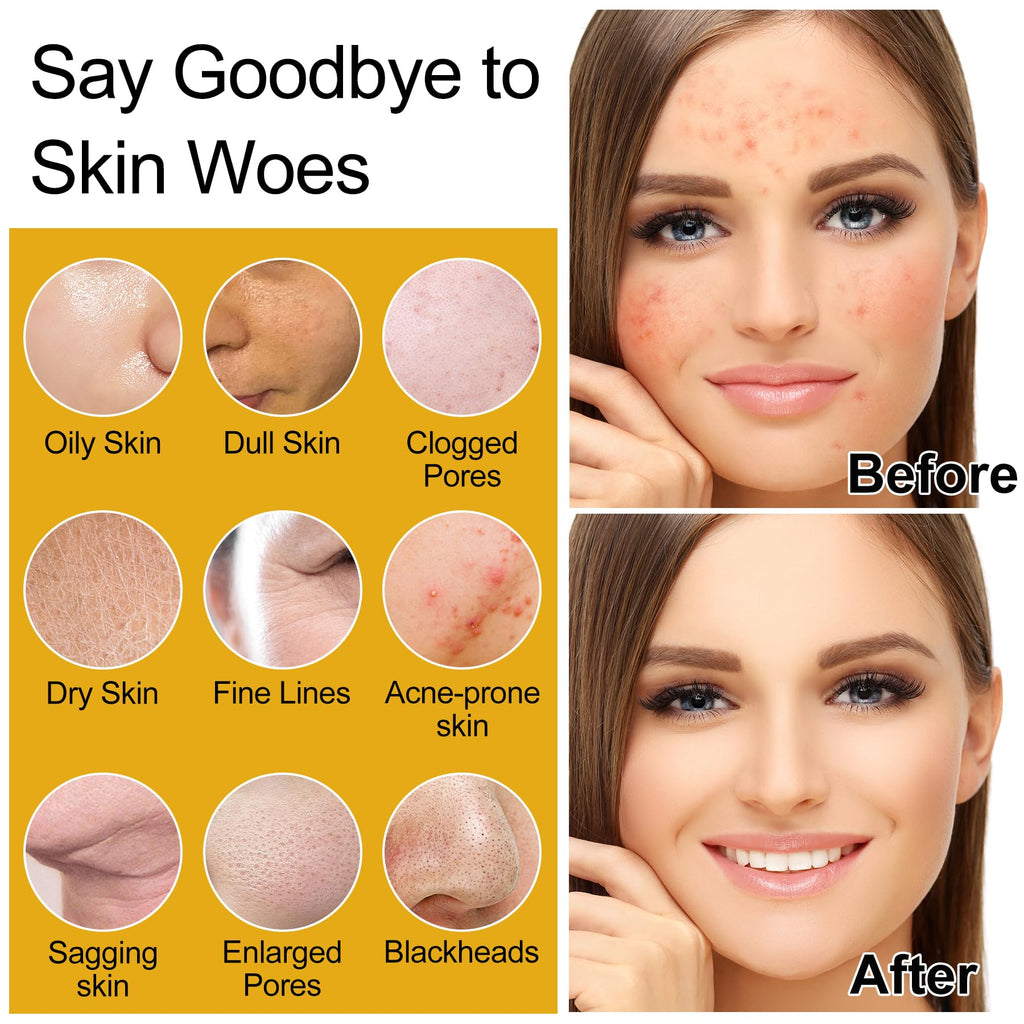 Skin Care Set,Women Teen Glass Skincare 6pcs w/Korean Rice Extract,Hydrate Glow Repair Anti-Aging Facial Routine Kit Gift for Women Mom Wife Teenage Girl Trendy Stuff Christmas Gifts Stocking Stuffers