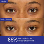 Caudalie Vinoperfect Dark Circle Brightening Caffeine Eye Cream with Niacinamide, Fragrance Free - 15 mL
