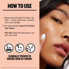 PEACE OUT Acne Healing Dots Hydrocolloid Pimple Patches, Acne Spot Treatment with Salicylic Acid, Retinol, and Aloe Vera for Blemishes and Breakouts, 40 Count