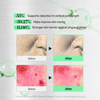 VT COSMETICS CICA Reedle Shot 100, Spicule Microneedling Serum for Pore Care & Exfoliation, Exosome, Centella Asiatica for Glass Skin, Skin Texture, Korean Liquid Skin Booster (1.69 Fl Oz / 50ml)