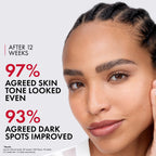 Vichy LiftActiv B3 Serum, 8% Niacinamide + Melasyl + Glycolic Acid, Anti-Aging Dark Spot Corrector for Uneven Skin Tone, Lightweight Face Serum for Women & Men, Non-Sticky
