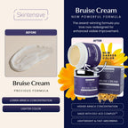 SKINTENSIVE Arnica Bruise Cream for Thin Skin - Moisturizing Arnica Cream, Vitamin K C and E, Skin Renewal, 4 Oz