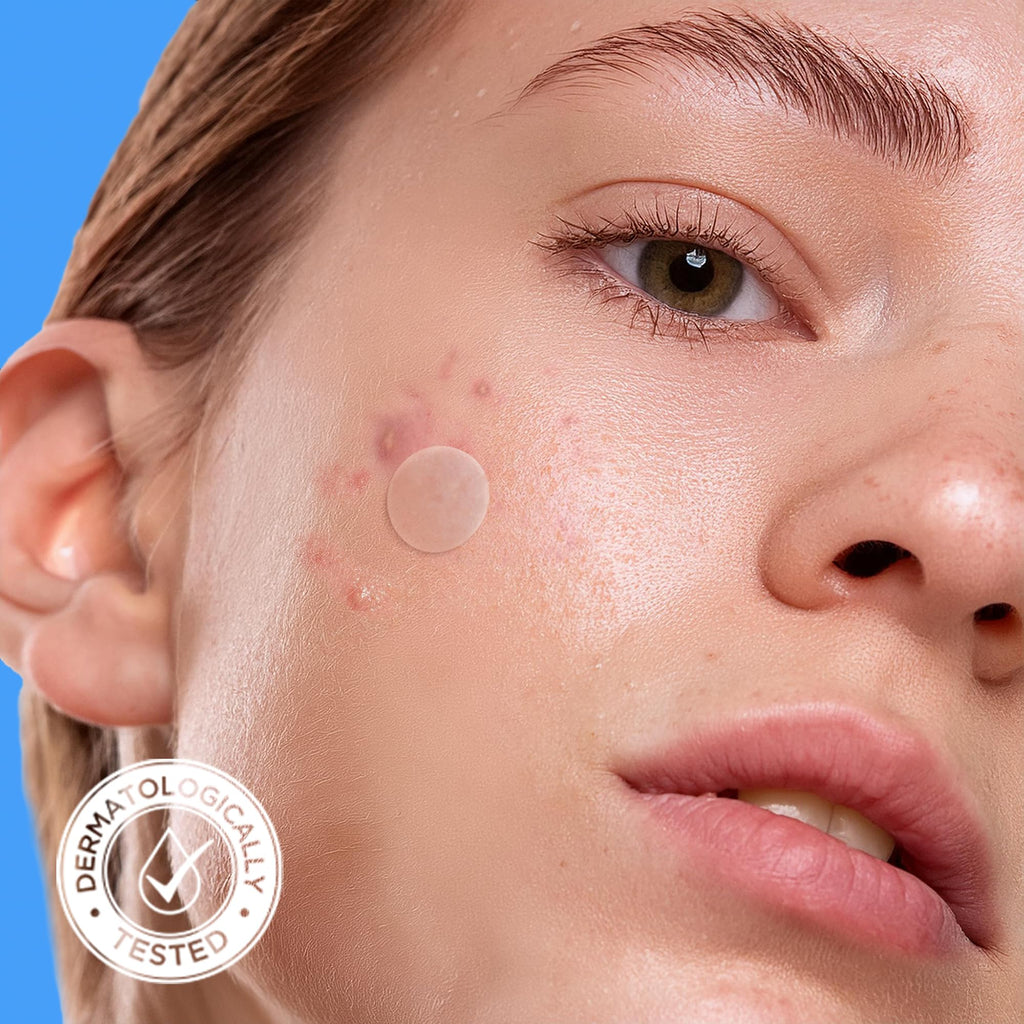 AVARELLE Pimple Patches for Face | Hydrocolloid Acne Patches for Covering Blemishes | FSA HSA Store Eligible Zit Patches with Tea Tree, Calendula, & Cica | (10-14 mm, 300 Count) Bulk Pack