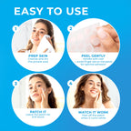 PatchRx Pimple Patches for Face (500 Patches), Hydrocolloid Acne Patches with Tea Tree Oil, Pimple Patch Pimple Stickers - Hydrocolloid Patch Acne Dots - Acne Pimple Patches For Face - Zit Patches