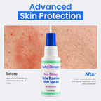 Safe n' Simple Skin Barrier Spray No-Sting - 2oz Bottle - Alcohol-Free Skin Prep Spray, Odor-Free Barrier Film for Ostomy Care, Stoma Skin Protection, Adhesive Prep for Medical Tapes and Dressings