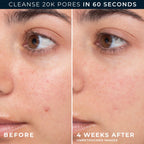 RoC Barrier Renew Gel to Foam Non Drying Foaming Facial Cleanser to Hydrate Skin, facial cleanser for sensitive skin, 12 Ounces