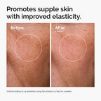 The Ordinary Serum Favorites Set – Hyaluronic Acid 2% + B5, Niacinamide 10% + Zinc 1%, Caffeine Solution 5% – Eye and Face Serums for Hydrating, Brightening & Pore-Minimizing Skin Care
