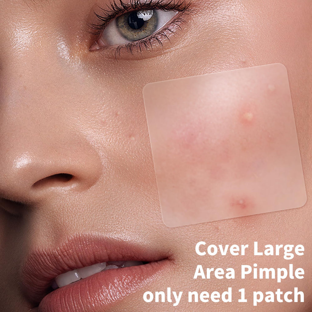 Daolyo Large Pimple Patches for Face, 8 Sizes 400 Counts XL Acne Patches, Big Hydrocolloid Bandages for Body, Chin, Forehead, Chest, Back Zit Breakouts (Strip, Square, Round, Moon)