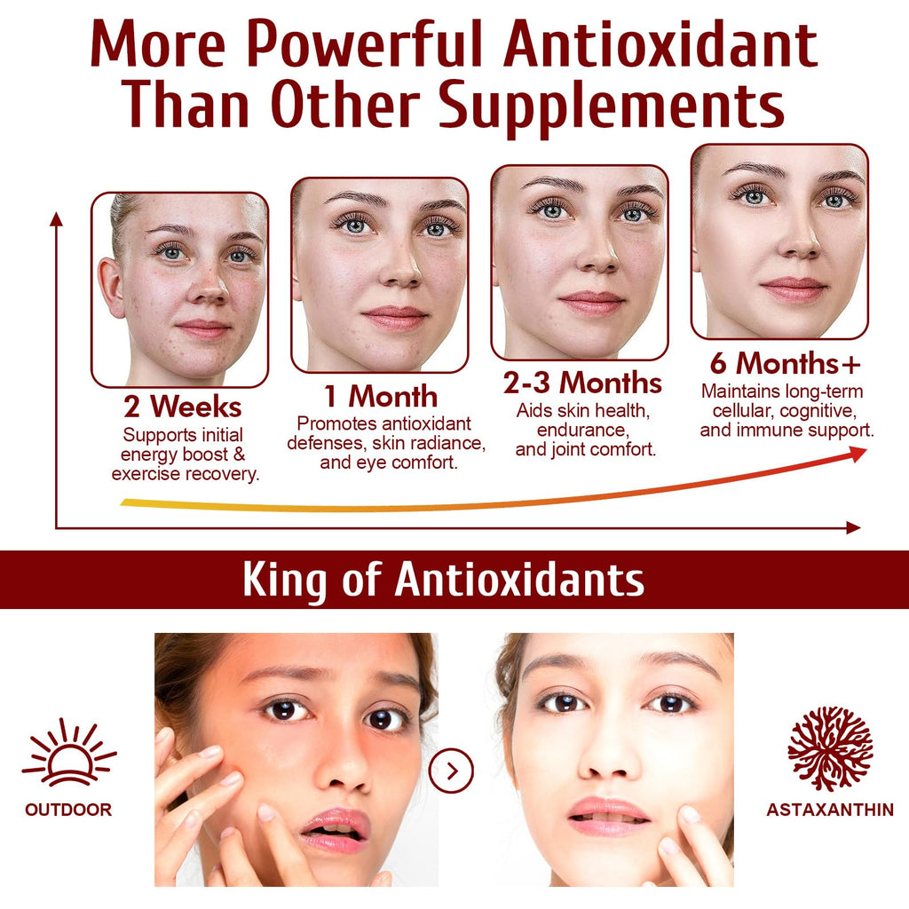 2 Pack Astaxanthin 12mg,Premium Astaxanthin Antioxidant Supplements with Antioxidant Activity, Supports Eye, Immune, Joint, Skin Health, Internal Circulation