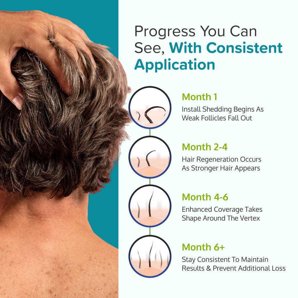 C'rcle Minoxidil for Men 5% Foam, Hair Regrowth Treatment, 3 Month Supply