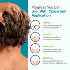 C'rcle Minoxidil for Men 5% Foam, Hair Regrowth Treatment, 3 Month Supply