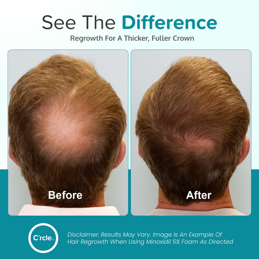 C'rcle Minoxidil for Men 5% Foam, Hair Regrowth Treatment, 3 Month Supply