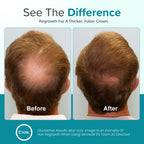 C'rcle Minoxidil for Men 5% Foam, Hair Regrowth Treatment, 3 Month Supply
