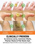 Samsali Wart Corn Remover Pads for Feet: 42 Pack Salicylic Acid Extra Strength Bandages for Plantar Warts Corns Small Callus on Feet Hands Toes - Safe Effective Treatment for Adults Teens