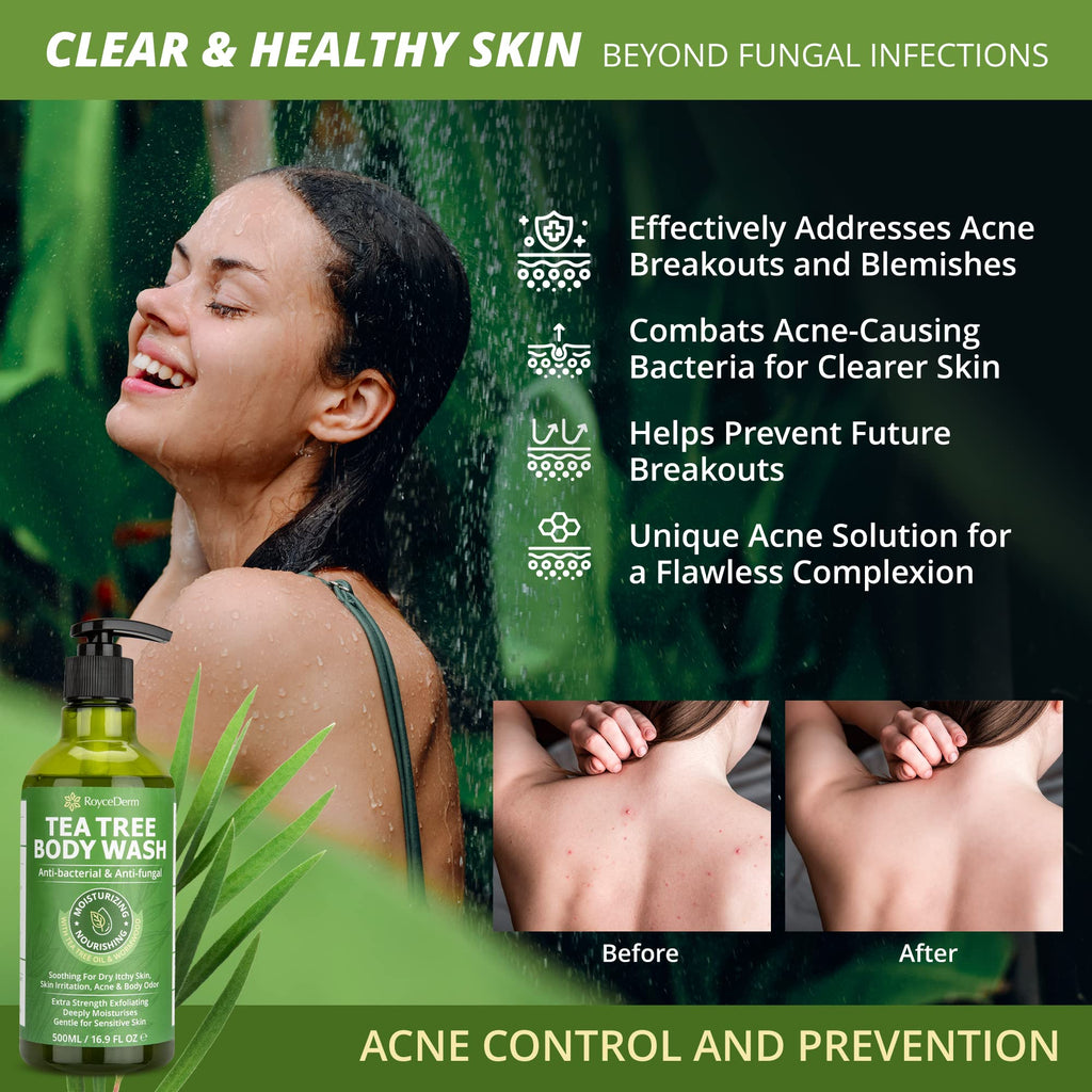 Roycederm Tea Tree Antifungal Care Bundle: Body Wash & Shampoo for Skin and Scalp Health