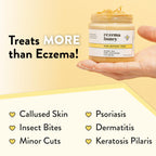 ECZEMA HONEY Original Skin-Soothing Cream - Organic Hand & Body Eczema Relief - Natural Honey Lotion for Dry, Itchy, & Irritable Skin (4 Oz)
