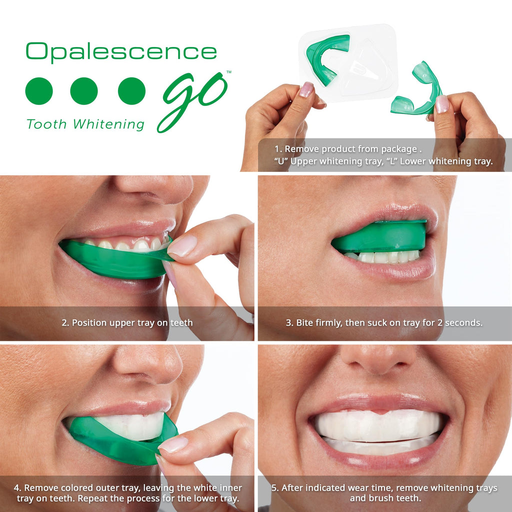Opalescence Go 15% Mint - Prefilled Teeth Whitening Trays - 5194