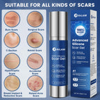 Rvlaim 100% Silicone Scar Gel Scar Cream, Advanced Silicone Gel for Removal of Surgical, Burns, Acne Scar, Old and Recent Scars and Stretch Marks, 1.7 oz/50ml
