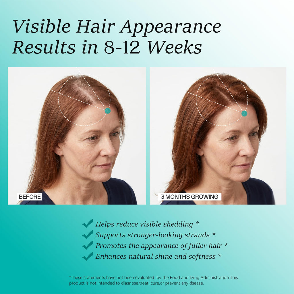 Hair Growth Supplements for Women, Ages 30 and Up - Clinically Tested for Visibly Thicker Hair with Biotin 10,000mcg, Vitamins, Keratin, Collagen, Saw Palmetto, Supports Scalp, Skin & Nails, 120 ct