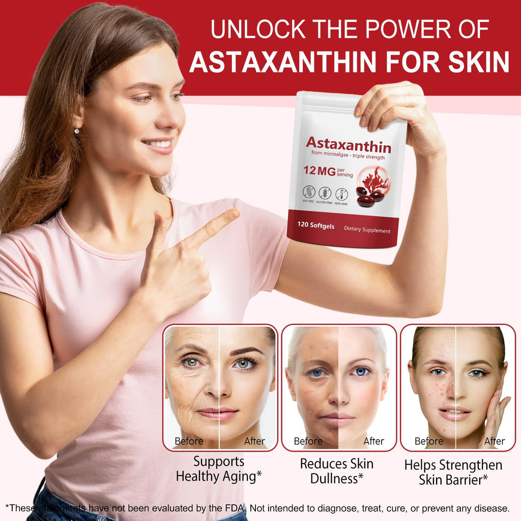 ITSDAWN Astaxanthin 12mg, 120 Softgels Antioxidant Supplement for Eye, Skin, Immune Support, Natural Microalgae Source, 4 Month Supply