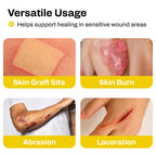 AWD Medical 4"x4" Xeroform Petrolatum Dressing, Non-Adherent Sterile Mesh Gauze for Burns, Skin Grafts, Surgical Wounds & Lacerations, Individually Wrapped (25 Count)