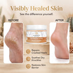 Vitality Extracts Frankincense Balm - 2oz, Boswellia Serrata, Beeswax, Olive Oil, Moisturizer for Dry, Cracked Skin, All Skin Types