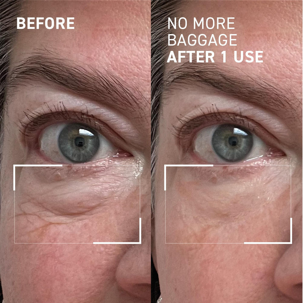 Dr. Brandt Needles No More, No More Baggage - Minimizes Under-Eye Bags, Puffiness & Dark Circles - 0.23 oz