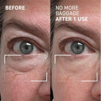 Dr. Brandt Needles No More, No More Baggage - Minimizes Under-Eye Bags, Puffiness & Dark Circles - 0.23 oz