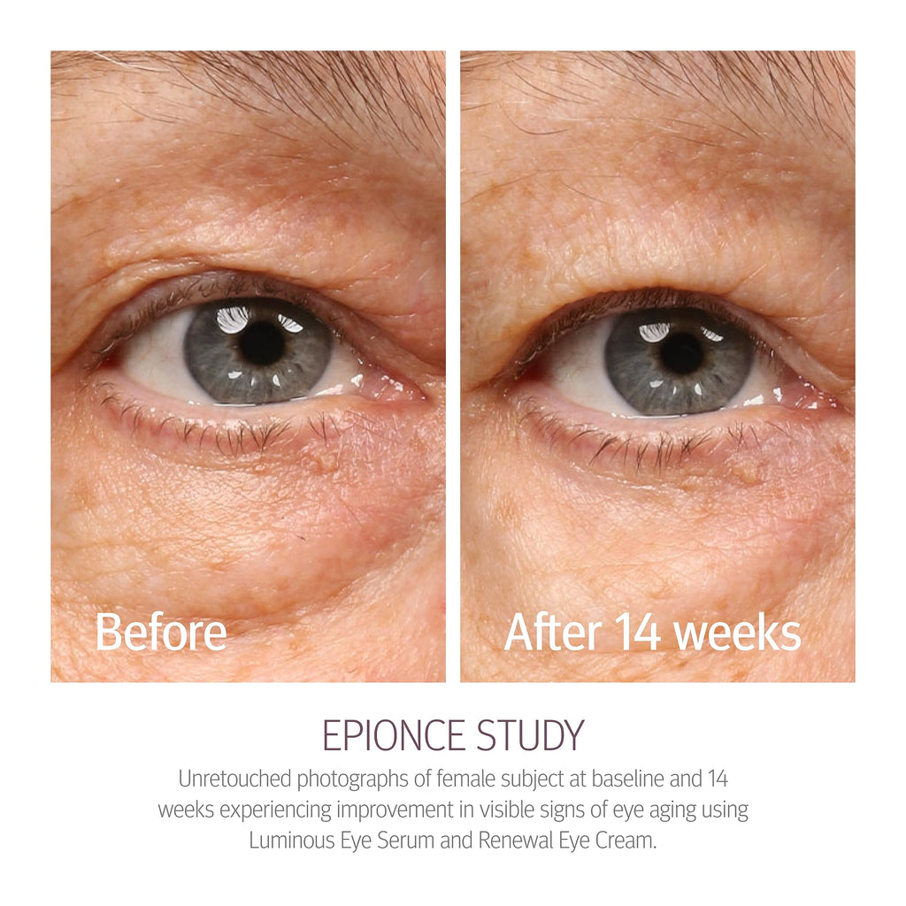 Epionce Renewal Eye Cream - Anti-Aging, Under Eye Cream for Dark Circles, Fine Lines, Wrinkles & Puffiness with Hyaluronic Acid, For All Skin Types, Dermatologist Skincare