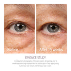 Epionce Renewal Eye Cream - Anti-Aging, Under Eye Cream for Dark Circles, Fine Lines, Wrinkles & Puffiness with Hyaluronic Acid, For All Skin Types, Dermatologist Skincare