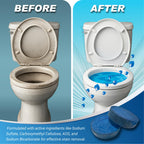 Shinefy Automatic Toilet Bowl Cleaner Tablets – 20 Tabs - Blue Gel Toilet Tank Cleaners, Hard Water Ring Remover, Septic-Safe Heavy-Duty Stain & Smell Eliminator, Toilet Cleaning & Deodorizer