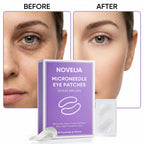 TAWODIUM Novelia Micro Eye Patches, Microglow Undereye Patches, Hyaluronic Acid Serum Infused Eye Masks, Reduce Puffy and Dark Circles, Firming Smile Line, Hydrating & Smoothing Skin (6Pairs) (1 Box)