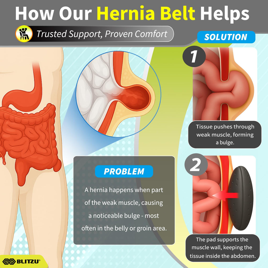 BLITZU Umbilical Hernia Belt for Men & Women, Abdominal Binder Adjustable Truss Support with 2 Compression Pads for Naval, Ventral, Incisional, Epigastric, Belly Button Hernias, Pre Post Surgery S-M