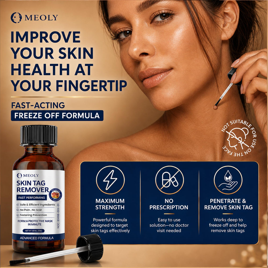 MEOLY Fast-Acting Skin Tag Remover : Salicylic Acid Skin Tag for Men and Women 30 ml