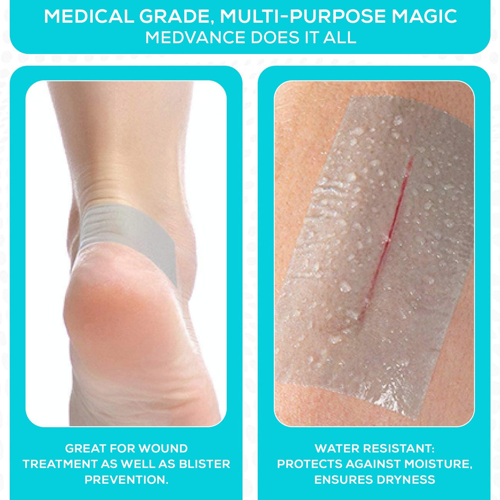 MedVance Silicone Adhesive Medical Tape, Scar Sheet, 2" x5' (1 Pack)