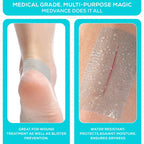 MedVance Silicone Adhesive Medical Tape, Scar Sheet, 2" x5' (1 Pack)