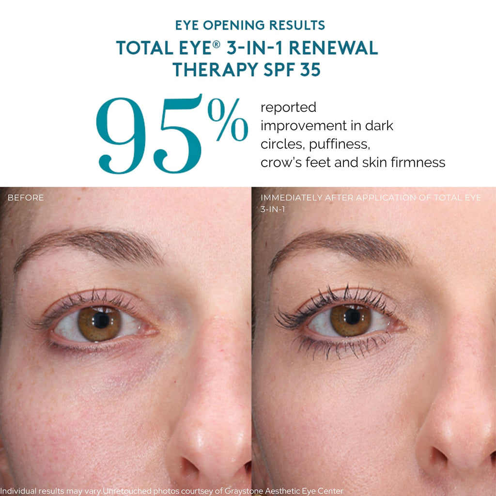 Colorescience Total Eye 3-in-1 Renewal Therapy, 0.23 Fl Oz, Medium