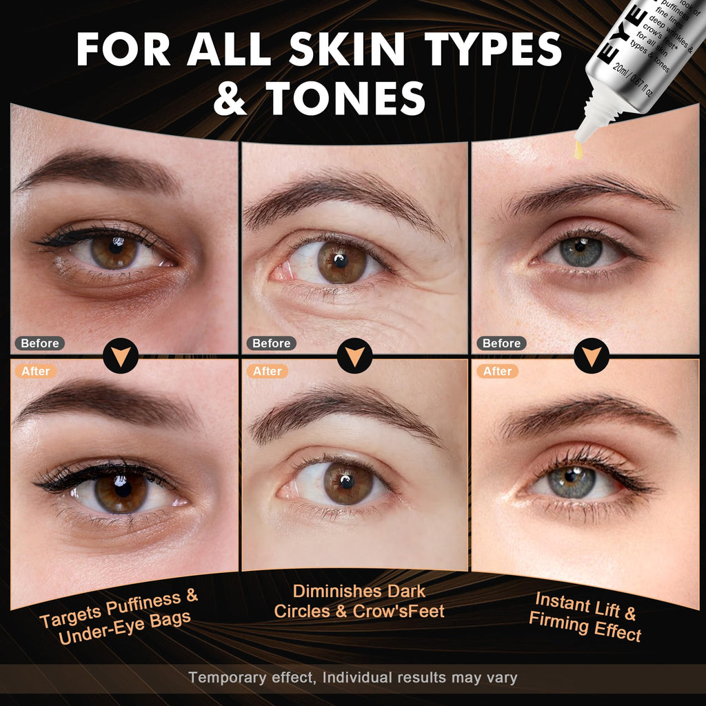 KKP Perfection Eye Tightener with Brush, Instant Firming Formula #526589 (20ML)