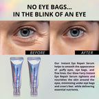 Eye Repair Serum (10g) – Under Eye Cream for Dark Circles, Puffiness, Fine Lines & Crow's Feet – Hydrate, Moisturize & Revitalize Skin with Caffeine Complex (2 Pack)