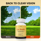 Besgiful Eye Supplement for Vitreous Health, Promotes Clear Vision, Improves Eye Strain & Dryness, Reduces Squiggly Lines, Eye Degeneration, Clear Eye Support, 90 Vegan Capsules