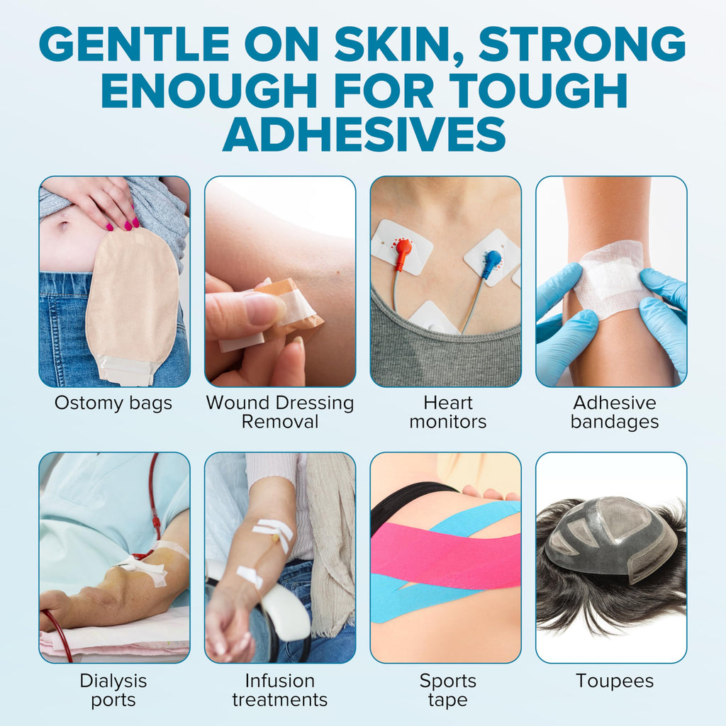 Ultimate Medical Adhesive Remover Spray – Silicone-Based, No-Sting & Odorless – Quick-Drying Bandage Adhesive Remover for Skin – Gentle, Low-Residue Formula for Sensitive Skin & Ostomy Care - 80 ml